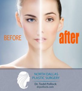 North Dallas Plastic Surgery Before & After