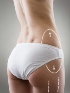 How to Choose Between Liposuction and Non-Surgical Fat Removal